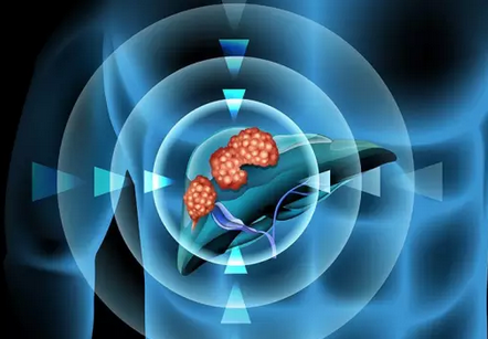 1489632861773083151.png QQ截图20170316105345.png