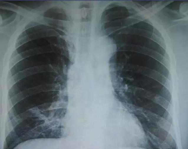 1537404814869021892.jpg 01.jpg