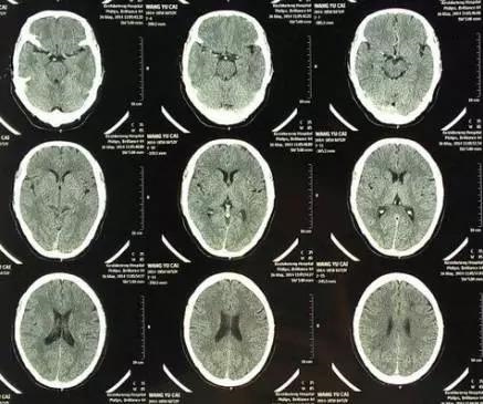 1537404821794099493.jpg 02.jpg