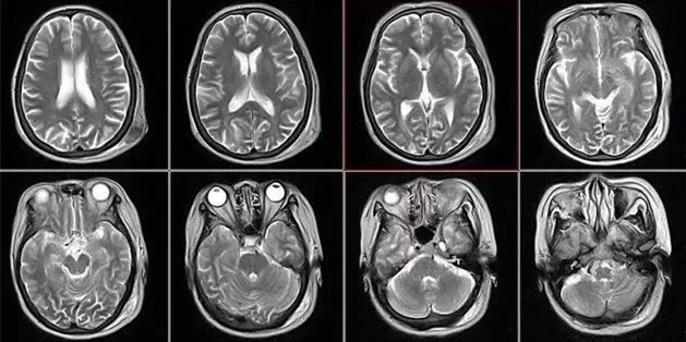 1537404834167015465.jpg 04.jpg